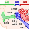 ヘルパーができる医行為でない行為⑨耳垢の除去