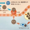 Lox-index（ロックス・インデックス）検査 〜 脳梗塞・心筋梗塞の発症リスクは❓