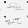 PFの扱いと問題点