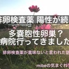 排卵検査薬がずっと陽性。多嚢胞性卵巣？陽性が続くので病院行きました。原因は？私には排卵検査薬が意味ないと言われた話