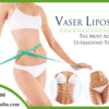Vaser Liposuction in Delhi – An Overview