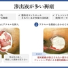 褥瘡を科学する