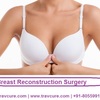 Undergoing Affordable Breast Reconstruction Surgery Following Mastectomy