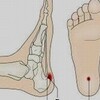 靴擦れはブリスター通じるってそれも許されないって注意で