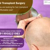 Hair Transplant Surgery to Overcome Baldness