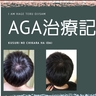 AGA治療