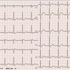 ECG-172:answer