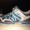 Mortons Neuroma Diagnosis