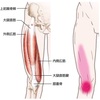 筋肉の解剖学part13 内側広筋編