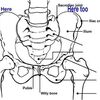 Functional Leg Length Discrepancy Definition