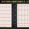 ECG-244：30才代 男性。胸部不快感にて、ER搬入です。