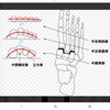 足の甲が痛いです。。