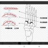 足の甲が痛いです。。