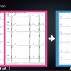 ECG-173：answer(2/3)