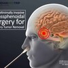 Avail Minimally Invasive Transsphenoidal Surgery for Pituitary Tumor Removal