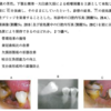 113回　歯冠補綴学振り返り　小矯正編