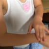 手や腕を振ると手首が痛いのを治す