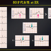 ECG-254：answer