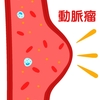 動脈瘤に関する雑学