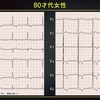 ECG-250：80才代女性。心電図で診断です。