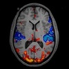 デザイン思考とfMRI？