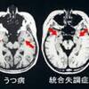 人間はなぜうつ病になるのか？