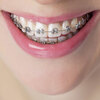 Picking Out A Superior Orthodontic