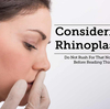 Reduction and Augmentation Rhinoplasty to Reshape Nose