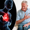 Do you know these strange facts about the heart attack?