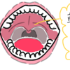 口唇口蓋裂と発音改善🔥軟口蓋めっちゃ大事🔥