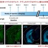 アミロイドβ抗体（アデュカヌマブ）はAβ・タウ動物モデルで，タウ病理・神経変性を抑制せず，グリア細胞を活性化する