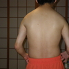 身体障害の話3　低身長　その他　膝蓋骨欠損　口唇口蓋裂　左目先天異常