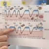 虫歯は歯磨きでは予防できない