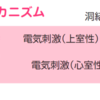 上室期外収縮と心室期外収縮の違い