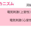 上室期外収縮と心室期外収縮の違い