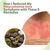 How I Reduced My Polycythemia Vera Symptoms with These 5 Remedies