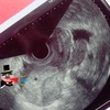 【大物マイペース君の誕生？】産婦人科に行ってきました