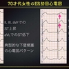 ECG-232：answer