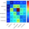  論文紹介: Holistic and Comprehensive Annotation of Clinically Significant Findings on Diverse CT Images: Learning from Radiology Reports and Label Ontology