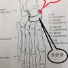 足部の痛みに100均の足まめぱっど