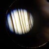 ダニに刺された！顕微鏡でダニ探し