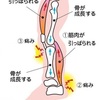 子供の成長痛について