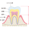 【お口の健康】なんでむし歯はできるとー？