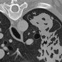 radsのカンタン！放射線診断ブログ