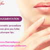 Lip Augmentation Surgery to Enlarge the Size of Lips by Injecting Fillers