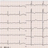 ECG-139：91才女性。めまいと気分不良でERヘ。