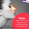 Nose surgery in Delhi - Important things you need to know about procedure 