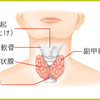 甲状腺ホルモンって何？