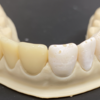 今後登場してくる、セラミックフィラー含有3Dプリントレジンの注意点② とても大切な後処理について