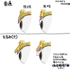 眼瞼下垂かどうかの判断は難しい②　～偽性眼瞼下垂とは？～
